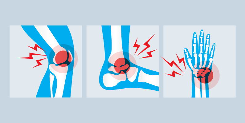 A image showing just a few of the different injuries that sports can cause. It shows a knee injury, a foot injury, and a hand injury. Photo credit to CSP Global.